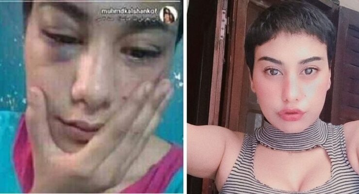 منه عبد العزيز