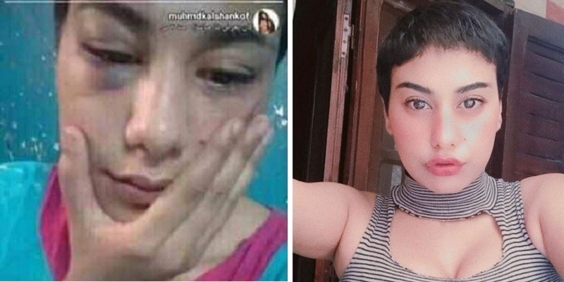 منه عبد العزيز