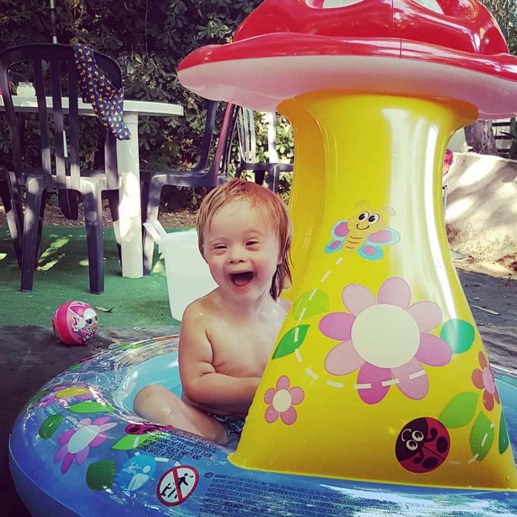 شاب يتبنى طفلة بمتلازمة داون بعدما رفضتها 20 عائلة داون