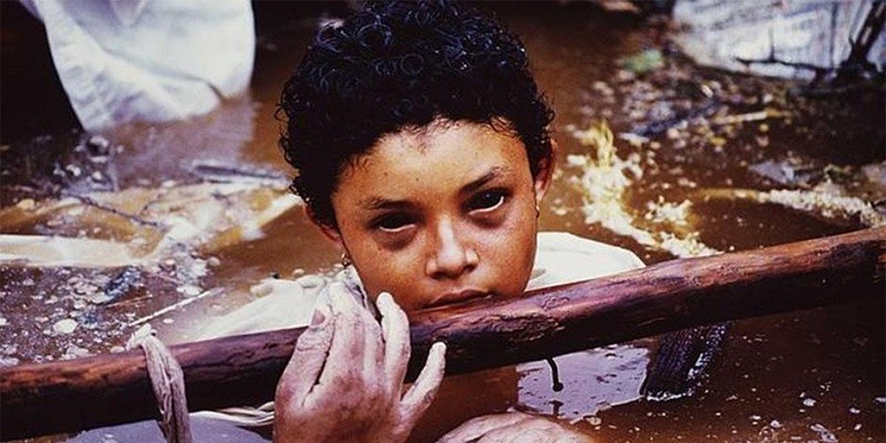 حكاية صورة .. ” أوميرا ” الطفلة التي أبكت العالم كله أوميرا