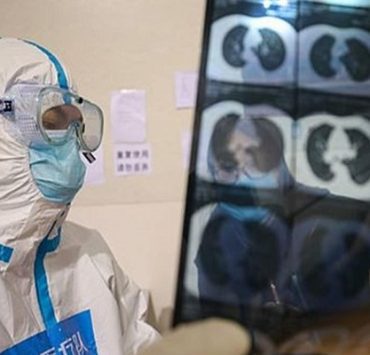 بعد مقتل أخر زرافة بيضاء..هل تعلم أن الزراف بأنواعه في طريقه للانقراض؟! فيروس كورونا