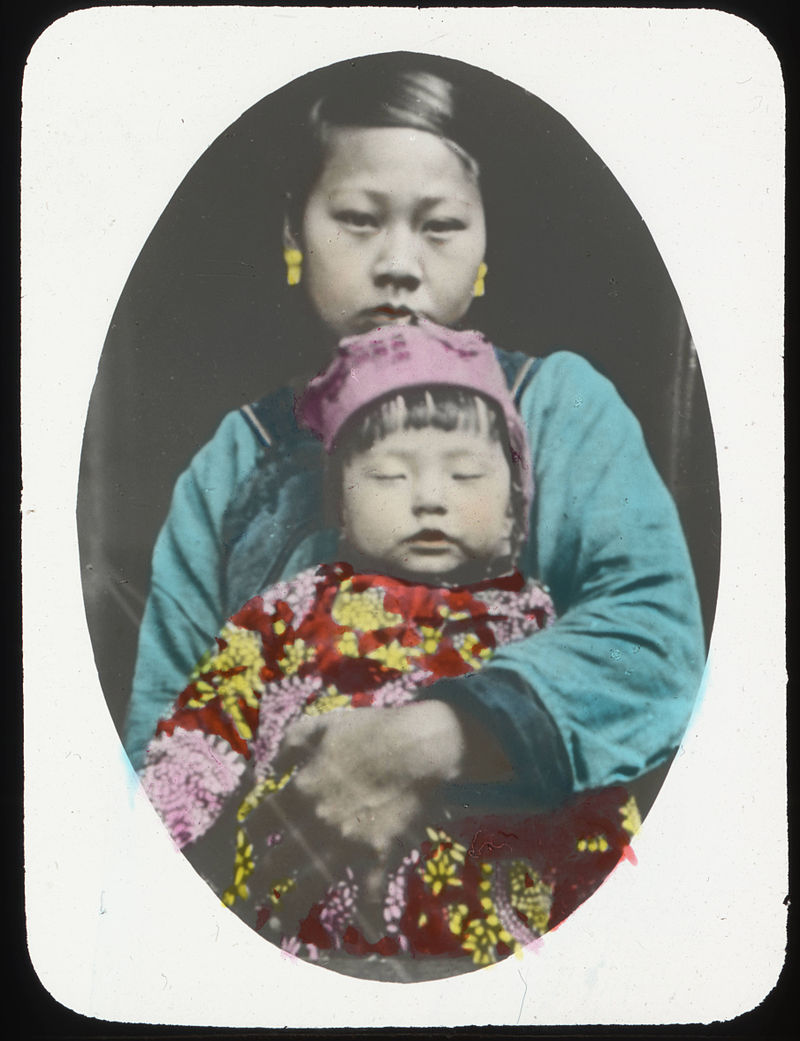 يوميات غرائب رمضان زمان (12) الصلع الجماعي يتفشى في أمريكا والنساء أول الضحايا طفلة عمياء مع أمها