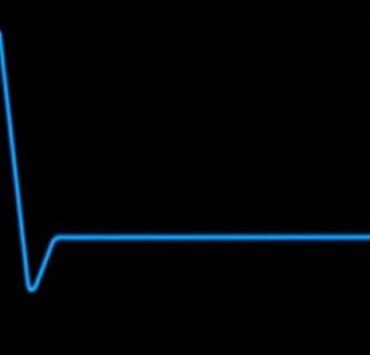 ما هي أكثر طرق الموت بشاعة طبقاً للعلم؟