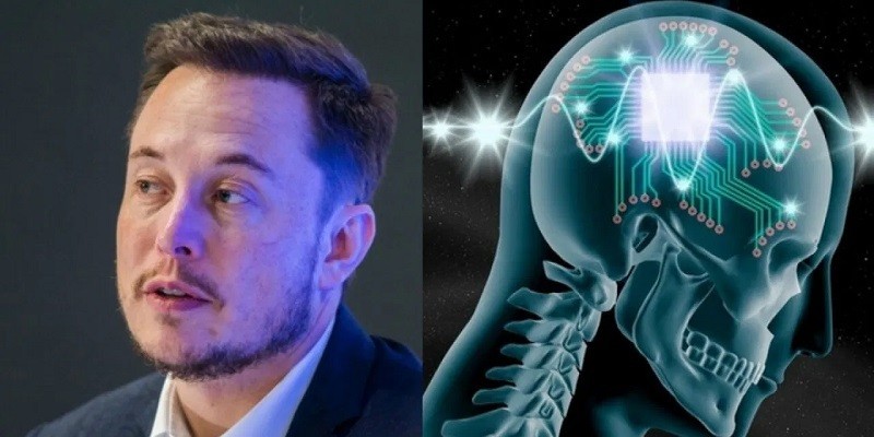 شريحة ايلون ماسك ... خيال علمي يصعب تحقيقه أم حقيقة صرنا نلمس تطبيقاتها بالفعل