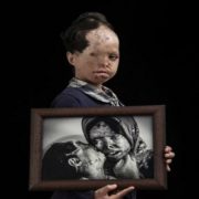 الغضب ...................................... يقذف بنيرانه على وجوه النساء