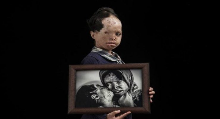 الغضب ...................................... يقذف بنيرانه على وجوه النساء