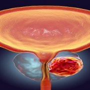 حادثة الكونيسة