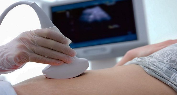 الحمل الكاذب