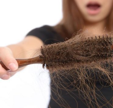 تساقط الشعر