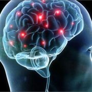 الدماغ