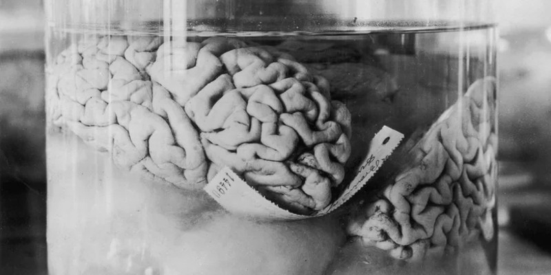 كيف تم استخدام العقول البشرية كعلاج في الماضي؟.. غذاء ودواء العقول