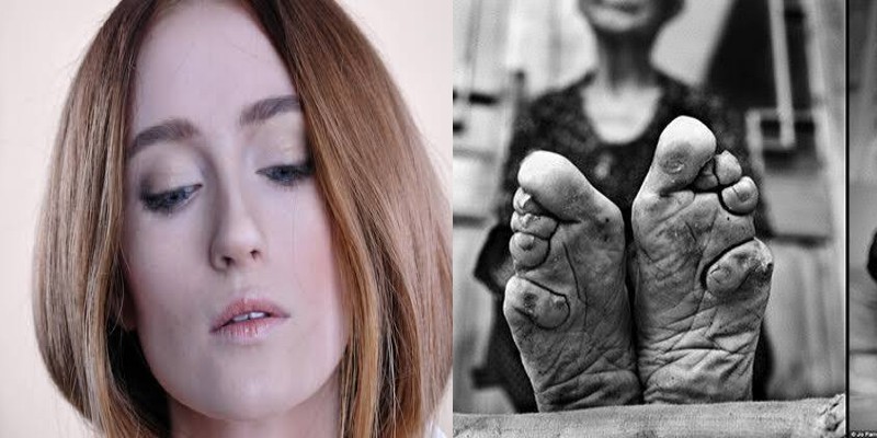 كسر الأقدام واستخدام سم الزرنيخ.. حيل جمالية مرعبة كن يلجأن لها قديمًا الجمال