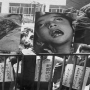 داء ميناماتا