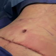 قائمة الانتظار