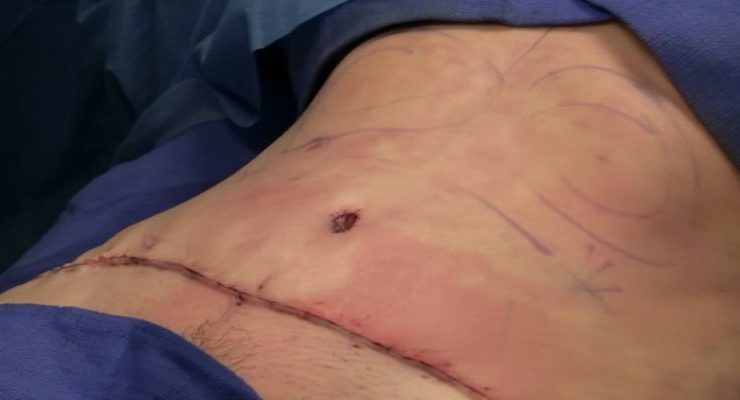 قائمة الانتظار