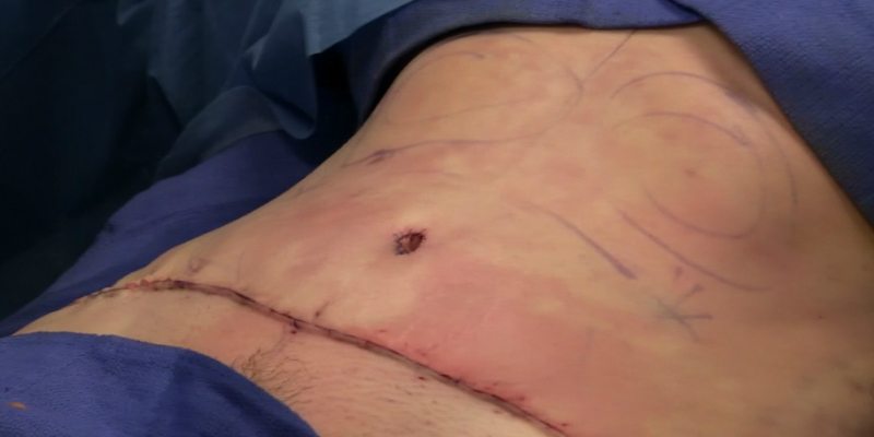 قائمة الانتظار