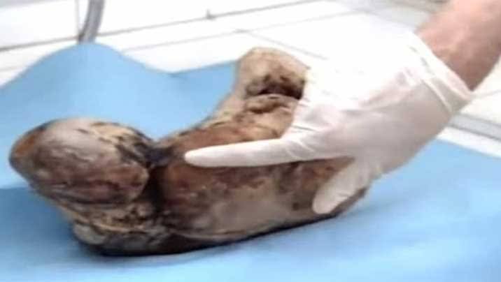 الطفل الحجري