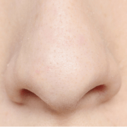 جزيرة اللفت