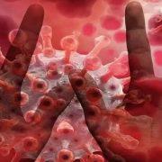 جدري القرود