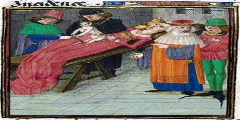 الولادة القيصرية