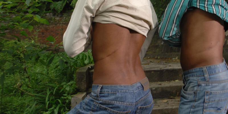 في أحد القرى الآسيوية كل شخص لديه كلية واحدة فقط كلية