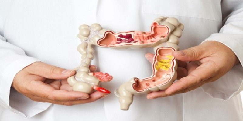 الزائدة الدودية