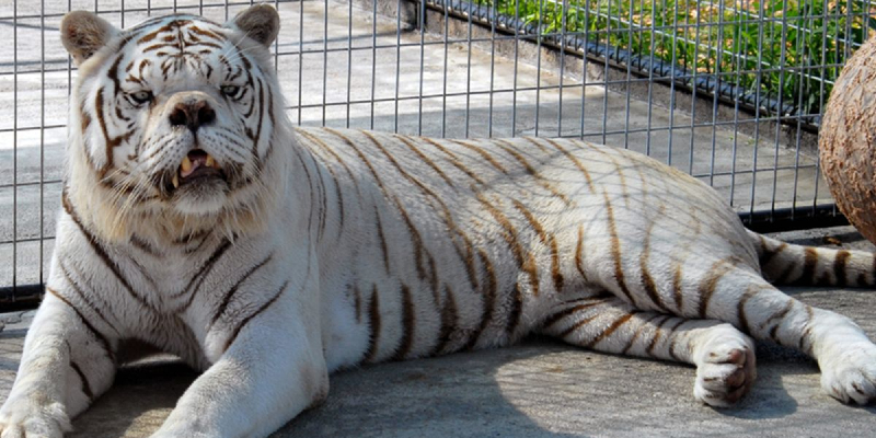 متلازمة داون