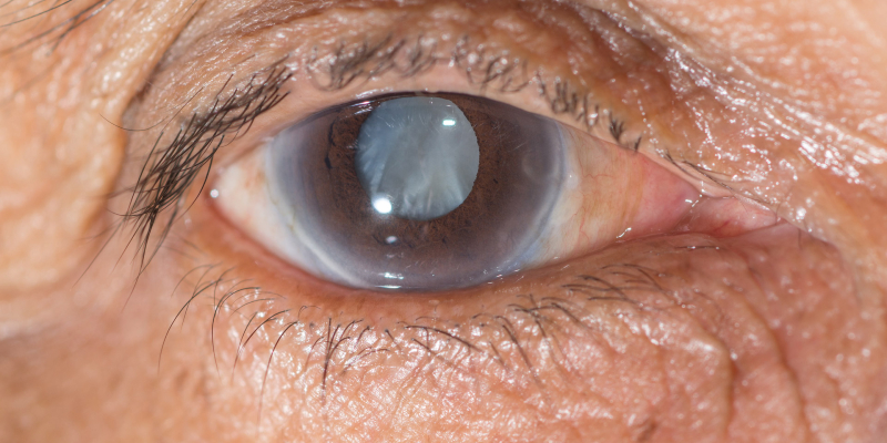 المياه الزرقاء