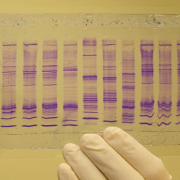 الحمض النووي