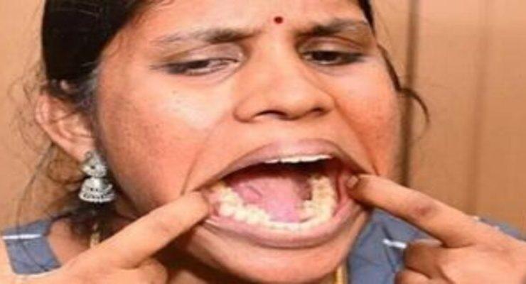 الشابة الهندية