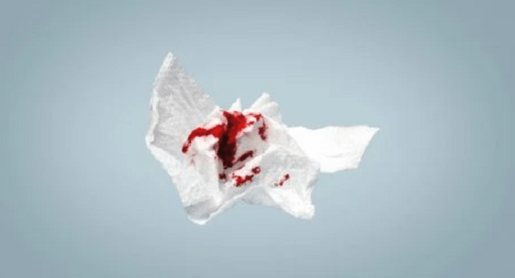 الدخلة البلدي