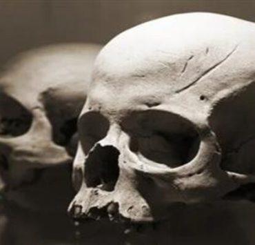 الزهايمر والتصلب المتعدد