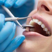 طبيب الأسنان