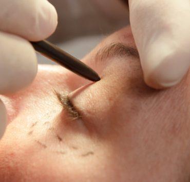 عملية تجميلية