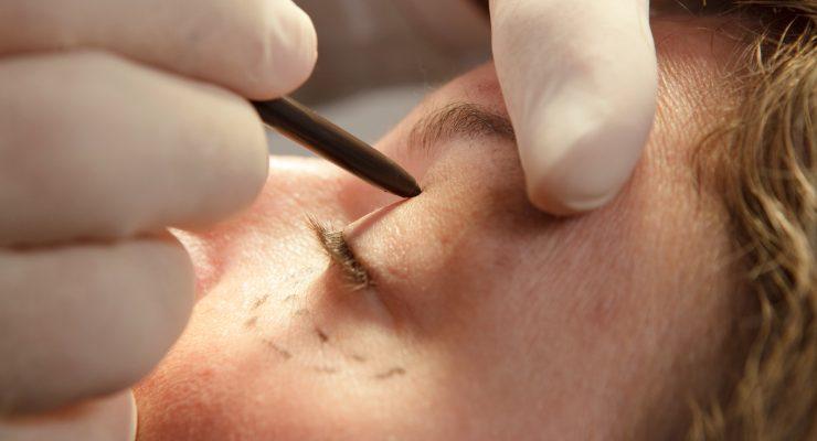 عملية تجميلية