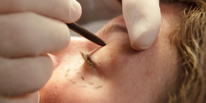 عملية تجميلية