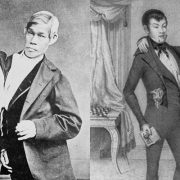 التوأم السيامي