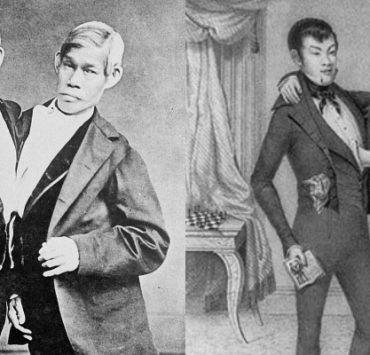 التوأم السيامي