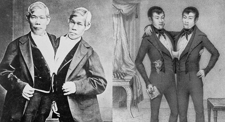 التوأم السيامي