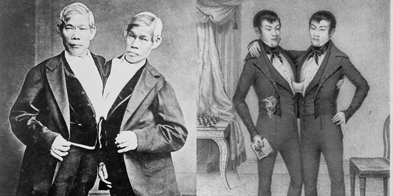 التوأم السيامي