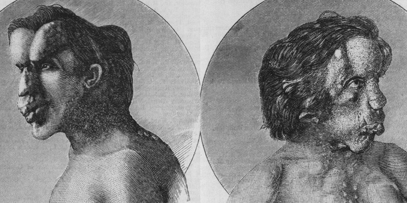 جوزيف ميريك..الرجل الفيل الذي أراد فقط أن يكون مثل أي شخص آخر الفيل